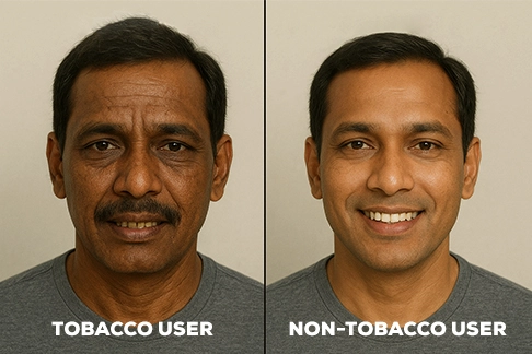 tobacco users vs non tobacco users look